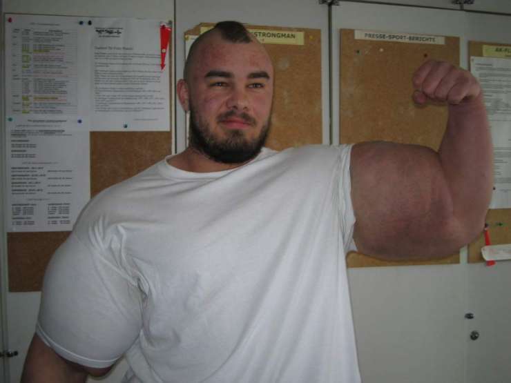 Synthol - steryd wypełniacz 15